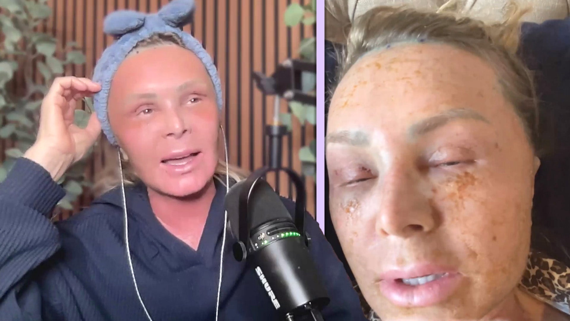 Tamra Judge Calls Viral Cosmetic Procedures a Birthday Present to Herself Exclusive